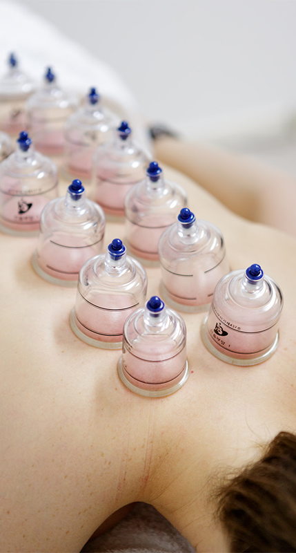 Massage cupping Carrum Downs